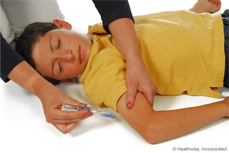 Pinching a fold of skin at the injection site