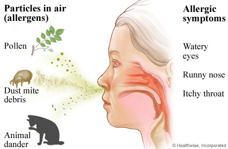 Breathing in pollen, dust mite debris, and animal dander, and the allergy symptoms they cause 