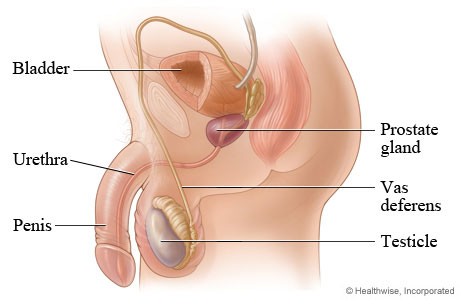 Picture of the prostate gland