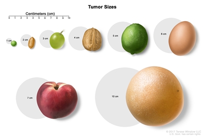 Tumor sizes; drawing shows different sizes of a tumor compared to the size of a pea (1 cm), peanut (2 cm), grape (3 cm), walnut (4 cm), lime (5 cm), egg (6 cm), peach (7 cm), and grapefruit (10 cm).