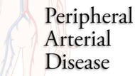 Angioplasty for Peripheral Arterial Disease