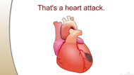 How a Heart Attack Happens