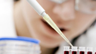  HIV: Understanding the Test