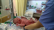 VBAC: Safe Labor After a Cesarean 