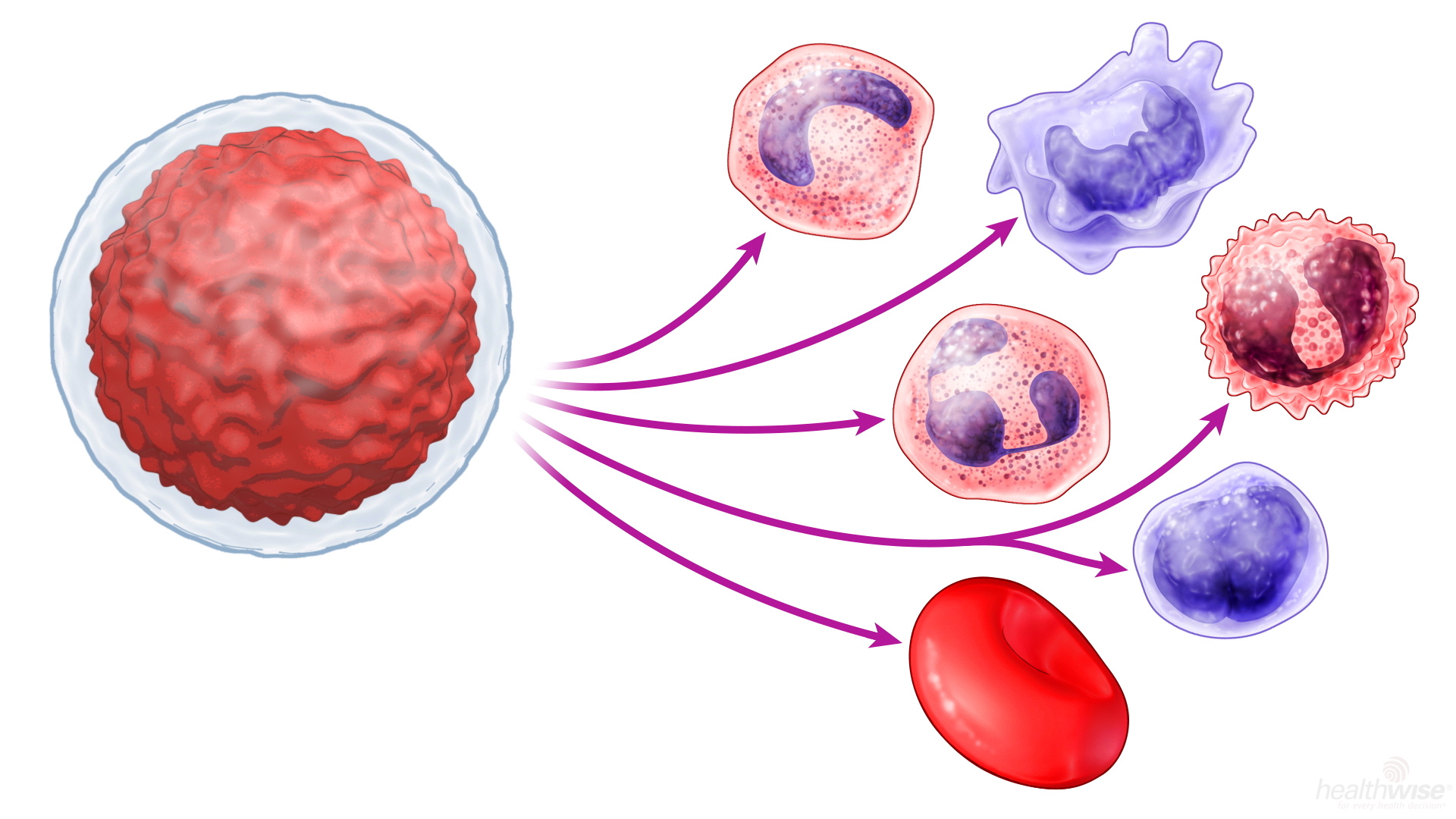  Bone Marrow Transplant: Before Your Procedure 